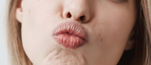 Сохнут губы у женщины причины