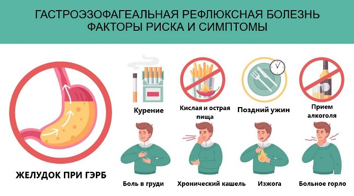 Гэрб гастроэзофагеальная рефлюксная