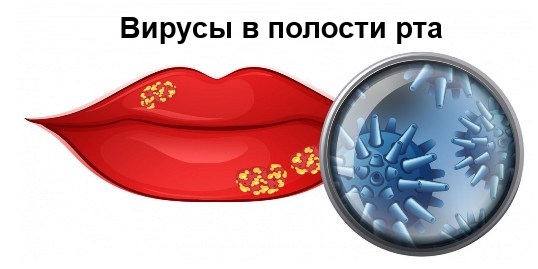 Почему появляется типун на языке